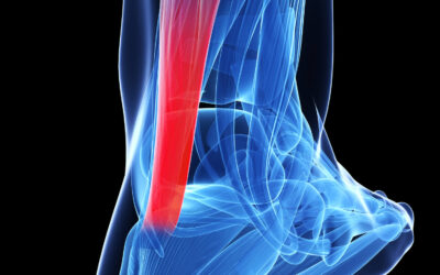 What is the best rehabilitation for Achilles tendon injuries?